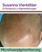 Microhaar Pigmentierung 068-