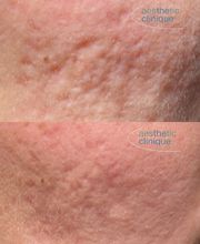 Aesthetic Clinique image 20