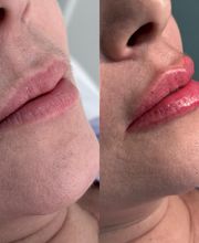 Estética Raphaela Santana imagen 14