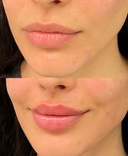 LivingYoung Center for Health & Anti-Aging image 10