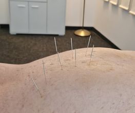 Oase TCM | Akupunktur, Chinesische Medizin für Baselland und Basel Bild 8