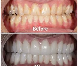Supreme Dental Clinic imagen 11