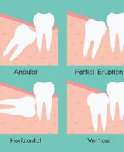 ZNZ Zahnärztliche Notfall Zentrale Bild 4