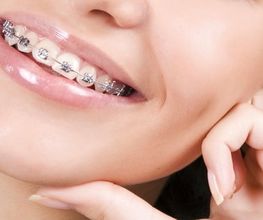 Cabinet d'Orthodontie Dr Monica Lordelo Bild 1