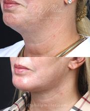 Gotham Plastic Surgery image 13