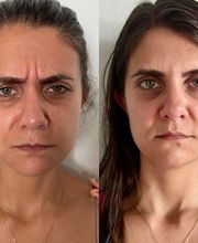 Estética Raphaela Santana imagen 1