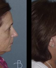 Agata Brys, MD Facial Plastic Surgery image 1