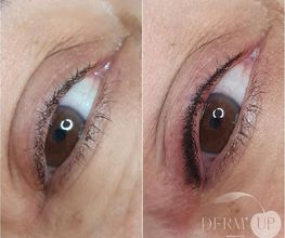 DERM UP image 4
