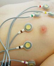 EKG