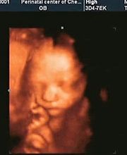 FOTO3.jpg