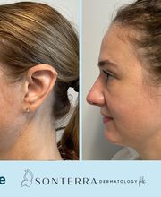 Sonterra Dermatology at The Pearl image 8