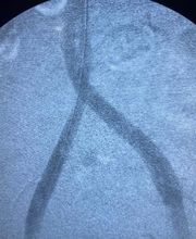 Downriver Heart & Vascular Specialists, PC image 5