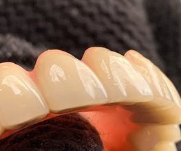Dentaltechnik Oriwal Bild 8