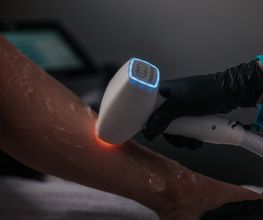 Haarentfernung mit Diodenlaser in Remscheid Wuppertal Solingen