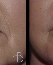 Agata Brys, MD Facial Plastic Surgery image 8