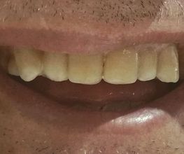 Clínica Dental Quart imagen 15