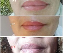 Néoly Beauty image 12