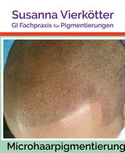 Microhaar Pigmentierung 068