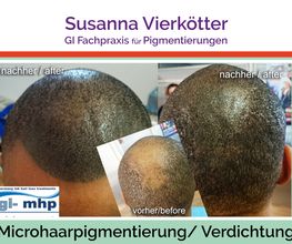 Microhaar Verdichtung 24