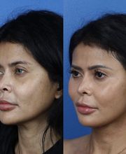 Gotham Plastic Surgery image 5