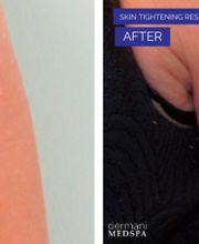 dermani MEDSPA Granger image 11