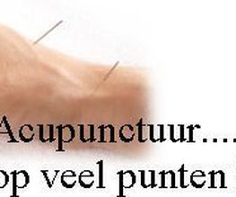 hand_erica_bernardus_acupunctu