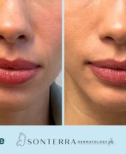 Sonterra Dermatology image 16