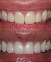 Metro Smiles P.C. image 14