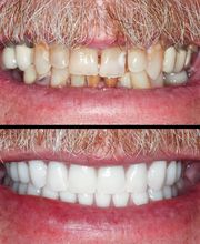 Flawless Smile Dentistry Claremore image 3
