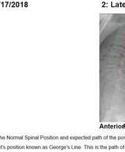 Strong Spine and Body image 5