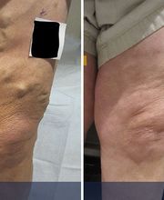 Specialty Vein Care image 4