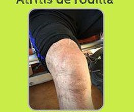 artritisrodillaacupunturqa.jpg