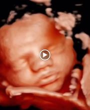 Ecox Dos Hermanas, Sevilla  Especialistas en ecografías 5D, 4D y 8K imagen 12