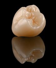 Palm Zahntechnik Inh. Sebastian Palm Bild 4