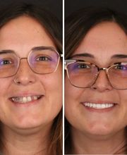 Britely Dentures + Implants Studio image 16