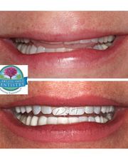Flawless Smile Dentistry Claremore image 2