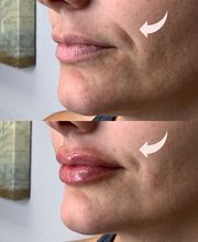 Flawless Med Spa image 3