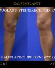 Gotham Plastic Surgery image 18