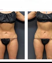 Grace Medspa & Body Solutions image 11