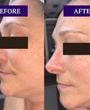 Flawless Skin & Spa image 12