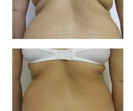 Endermospa image 3
