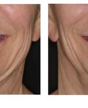 Aspen Ridge Dental image 6