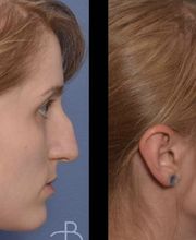 Agata Brys, MD Facial Plastic Surgery image 6