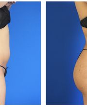 Ethos Plastic Surgery: Ginger Xu, M.D. image 3