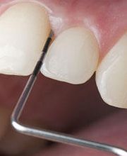 Neric Médecine dentaire I Zahnmedizin Bild 10