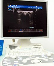 Ultraschalluntersuchung-Sonographie