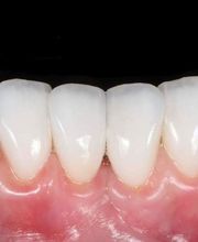 Clínica Dental Dres. Nuñez García imagen 6