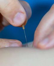 Physiotherapie Moser & Klumpp Bild 15