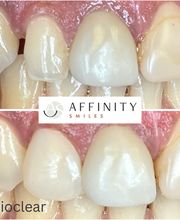 Affinity Smiles image 9