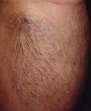 Consulta Barreiro-Vascular (Drs. A. Barreiro Mouro y J. Barreiro Veiguela) imagen 5